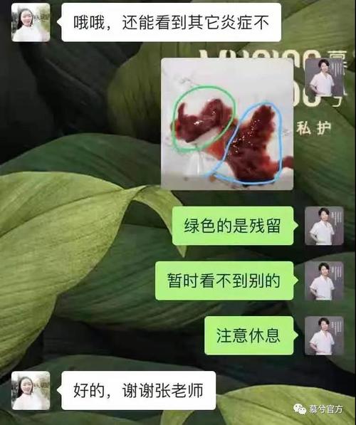 流产后的痛苦句子说说心情（流产后适合发朋友圈的诗句）