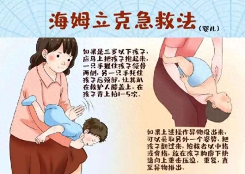 婴幼儿姆立克急救法怎么做（婴幼儿姆立克急救法）